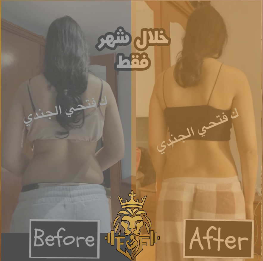 شيماء — قبل وبعد